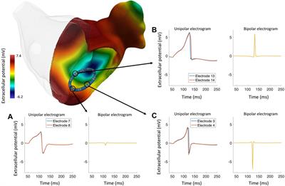 A Review of Healthy and Fibrotic Myocardium Microstructure Modeling and Corresponding Intracardiac Electrograms